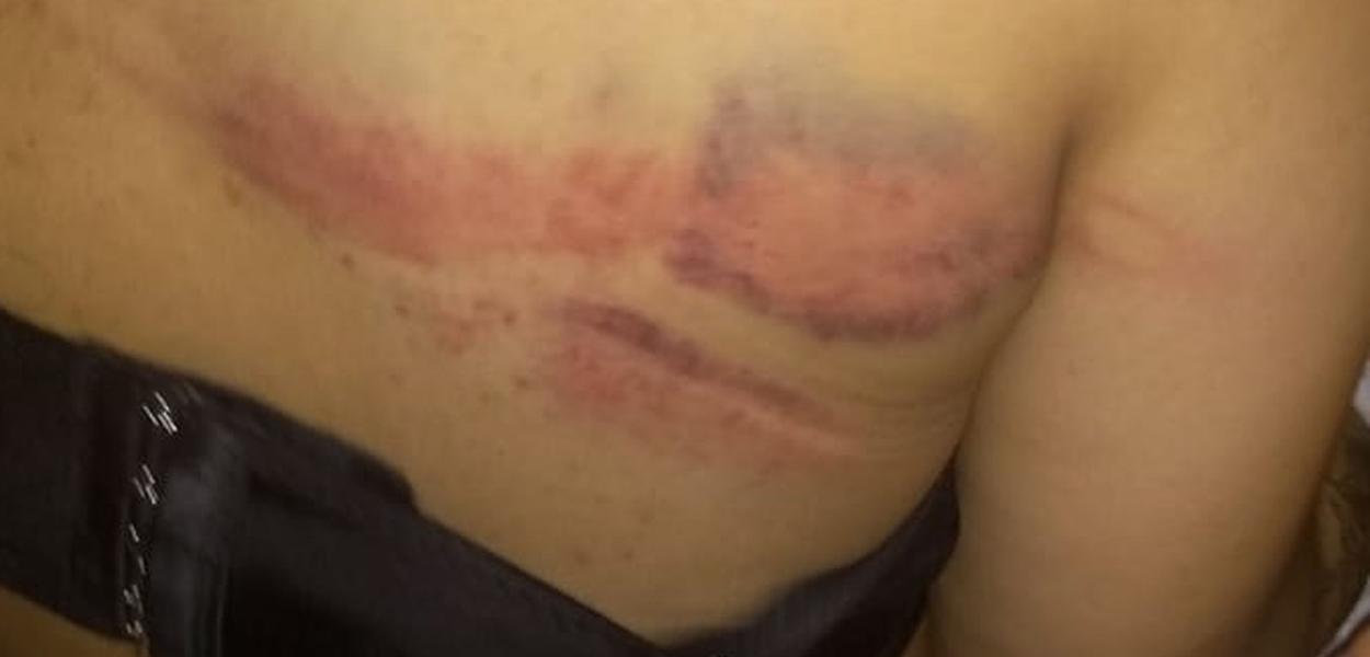 Adolescente é ferida pela Polícia em Paraisópolis em baile funk