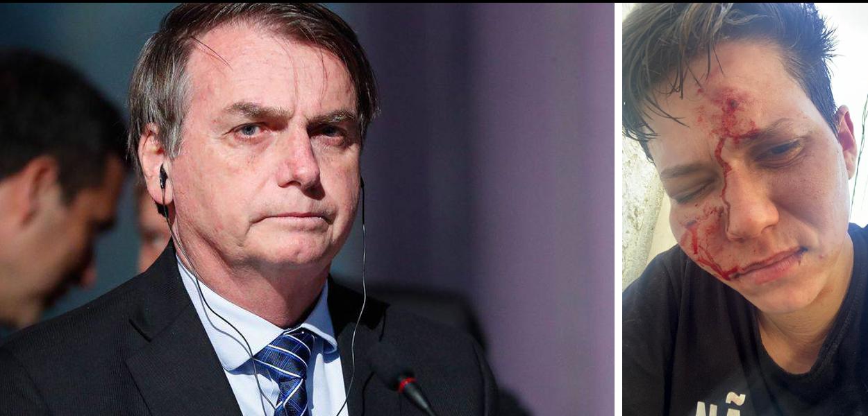 Bolsonaro e Karol Eller, agredida por homofobia