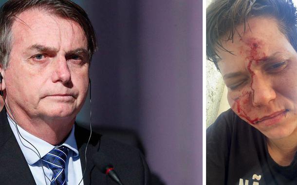 Bolsonaro e Karol Eller, agredida por homofobia
