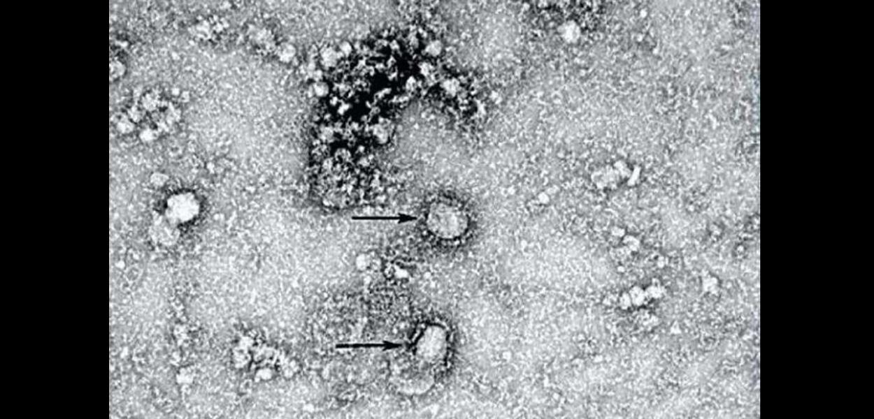 Primeira foto do novo coronavírus feita com microscópio eletrônico por cientistas chineses