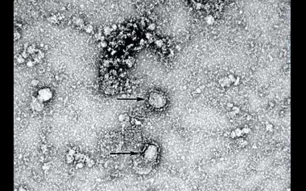Primeira foto do novo coronavírus feita com microscópio eletrônico por cientistas chineses