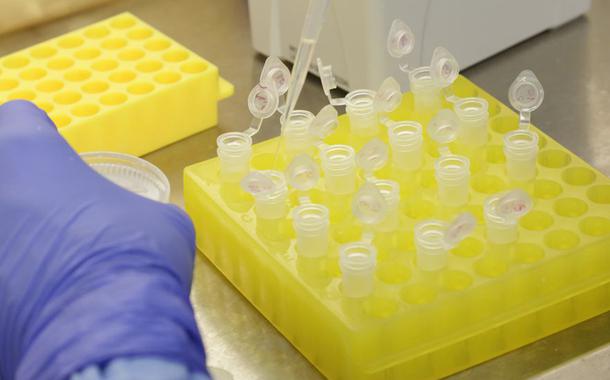 Diagnóstico laboratorial de casos suspeitos do novo coronavírus