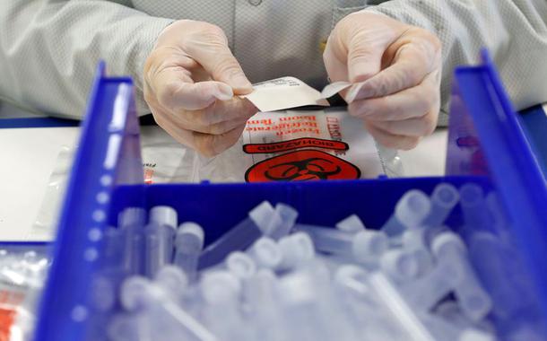 14º no ranking do coronavírus, Brasil é o que menos testa dentre os 15 com mais casos