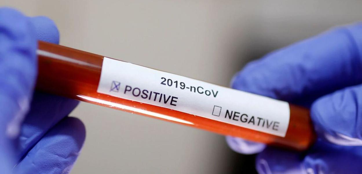 Chegada dos 5000 testes para coronavírus. Guarulhos - SP