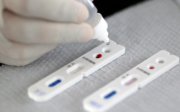 Profissional de saúde realiza teste para o novo coronavírus em Brasília