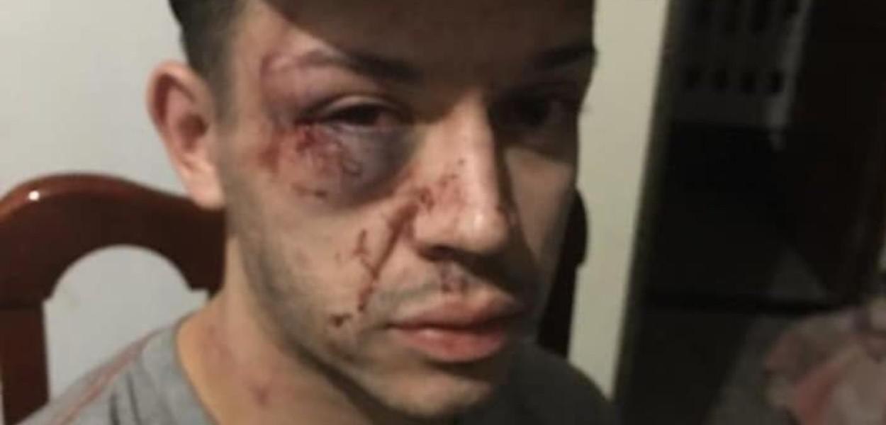Jovem espancado pela polícia