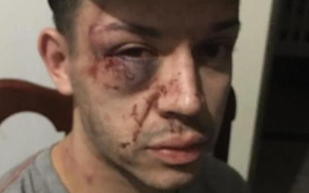 Jovem espancado pela polícia