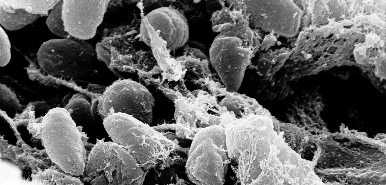 Credit:ʠRocky Mountain Laboratories, NIAID, NIH Scanning electron micrograph depicting a mass of Yersinia pestis bacteria (the cause of bubonic plague) in the foregut of the flea vector