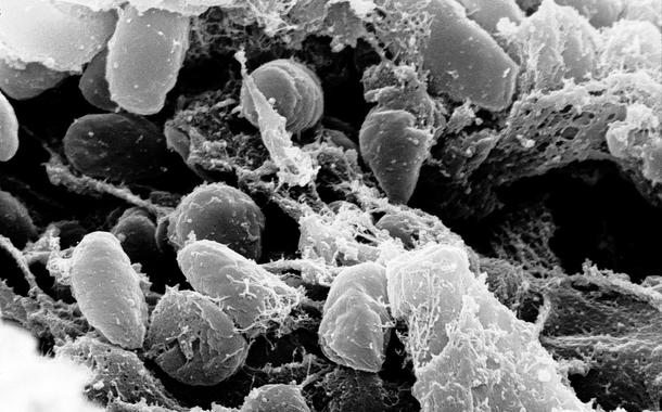 Credit:ʠRocky Mountain Laboratories, NIAID, NIH Scanning electron micrograph depicting a mass of Yersinia pestis bacteria (the cause of bubonic plague) in the foregut of the flea vector