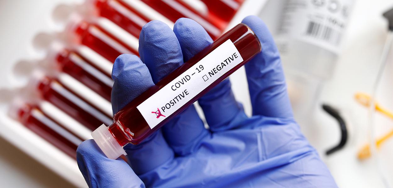 coronavirus - covid - teste