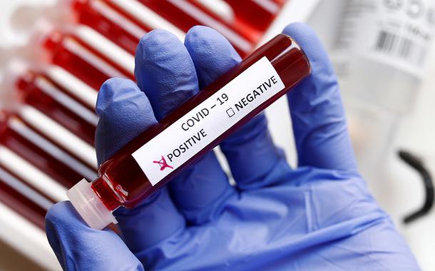 coronavirus - covid - teste
