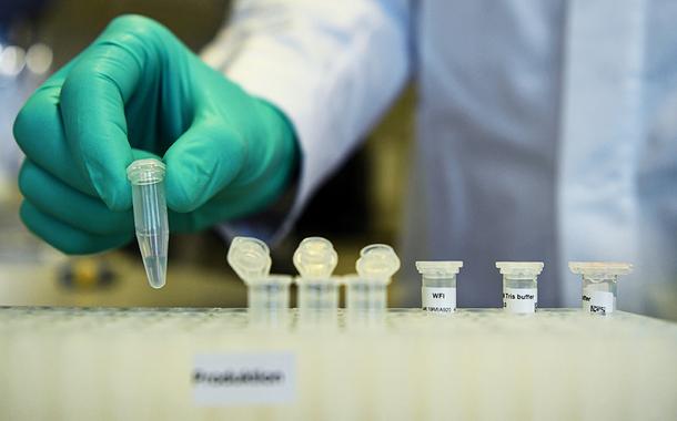 Instituto Senai de Inovação em Química Verde (ISI QV) e Scienco Biotecnologia, de Santa Catarina, formam parceria para inovação em testes da Covid-19