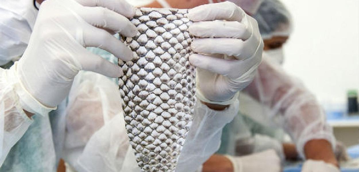 Pele de tilápia brasileira pode salvar vidas de queimados em Beirute