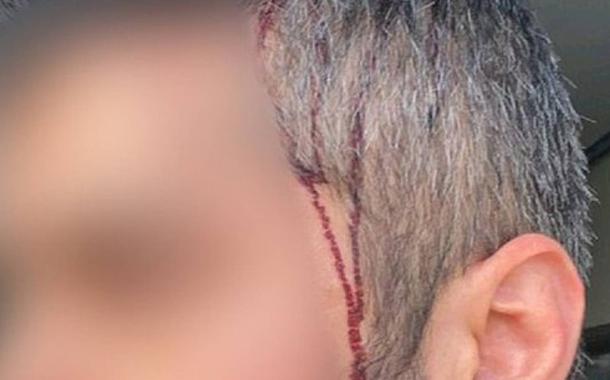 Sobrinho de Bolsonaro teria invadido casa e agredido atual companheiro da ex-namorada