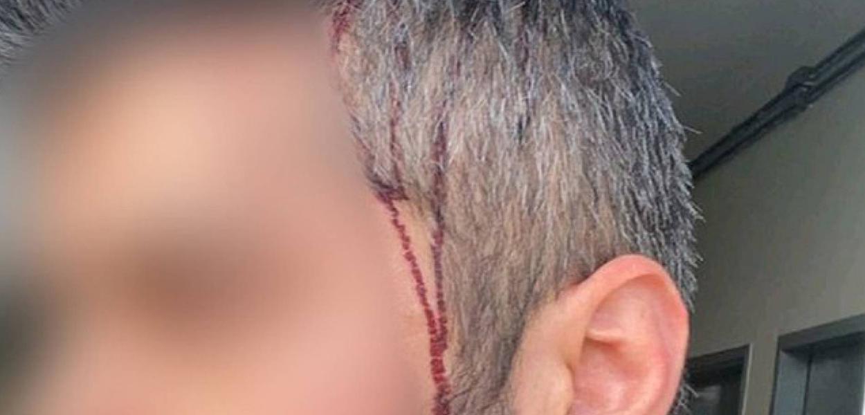 Sobrinho de Bolsonaro teria invadido casa e agredido atual companheiro da ex-namorada