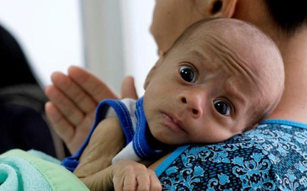 Mãe aguarda com seu filho de 2 meses, diagnosticado com desnutrição, por exame em clínica venezuelana