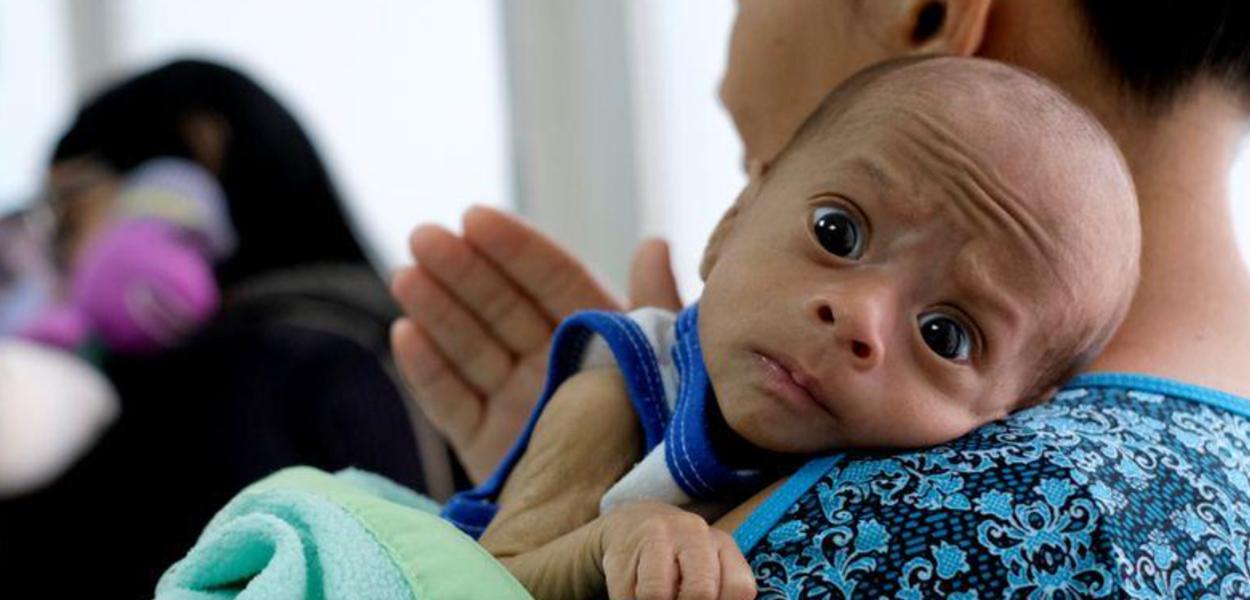 Mãe aguarda com seu filho de 2 meses, diagnosticado com desnutrição, por exame em clínica venezuelana