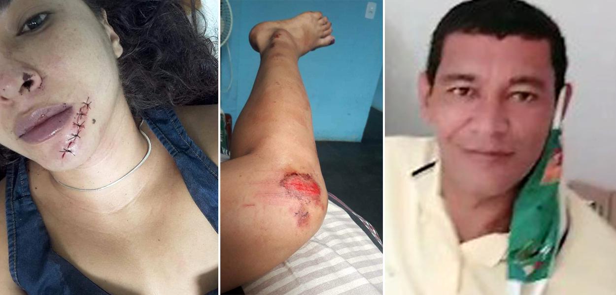 Crime em Araçuí-MG. Homem agride namorada