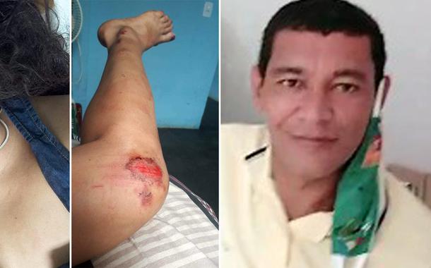 Crime em Araçuí-MG. Homem agride namorada