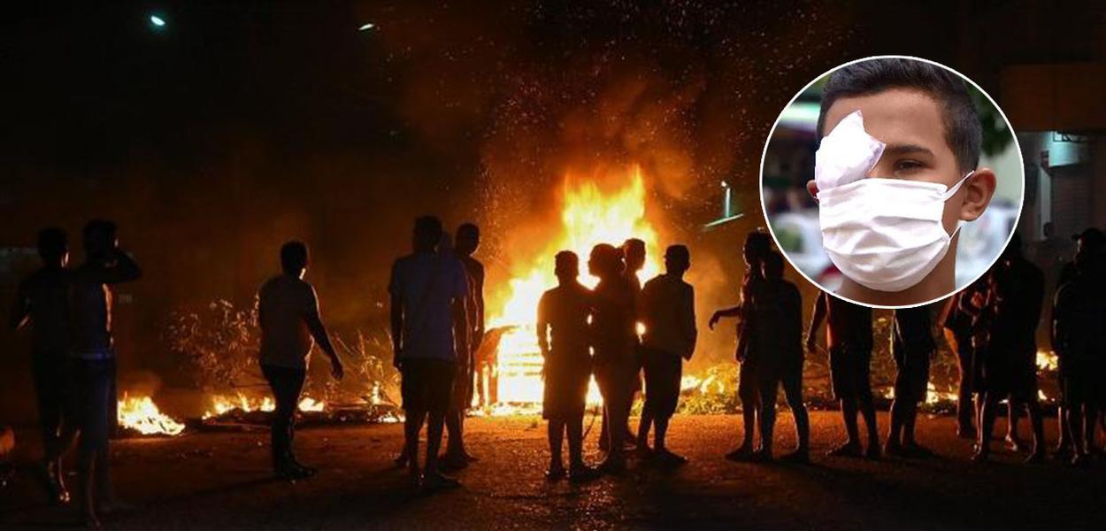 PM registra atos em várias localidades do Amapá. Em um deles um jovem perdeu a visão do olho direito