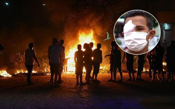 PM registra atos em várias localidades do Amapá. Em um deles um jovem perdeu a visão do olho direito