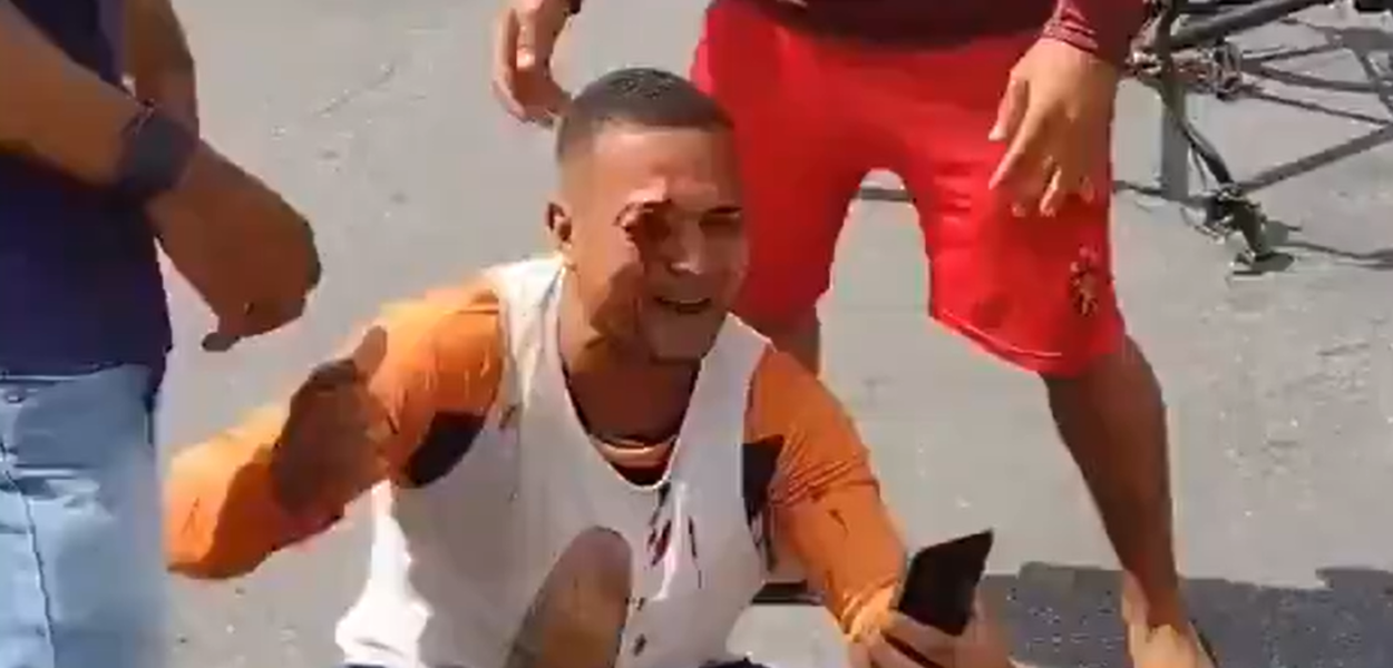 Desempregado Jonas Correia de França, 29 anos, é atingido por tiro pela PM no Recife e perdeu a visão do olho direito
