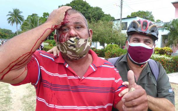 Operário ferido em Camagüey
