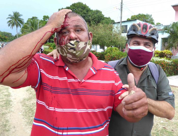 Operário ferido em Camagüey