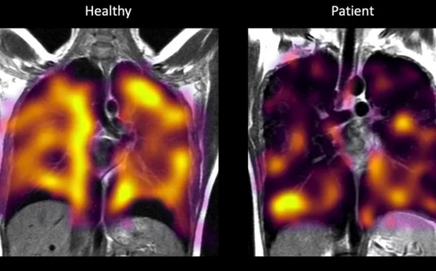 Saudável | Paciente