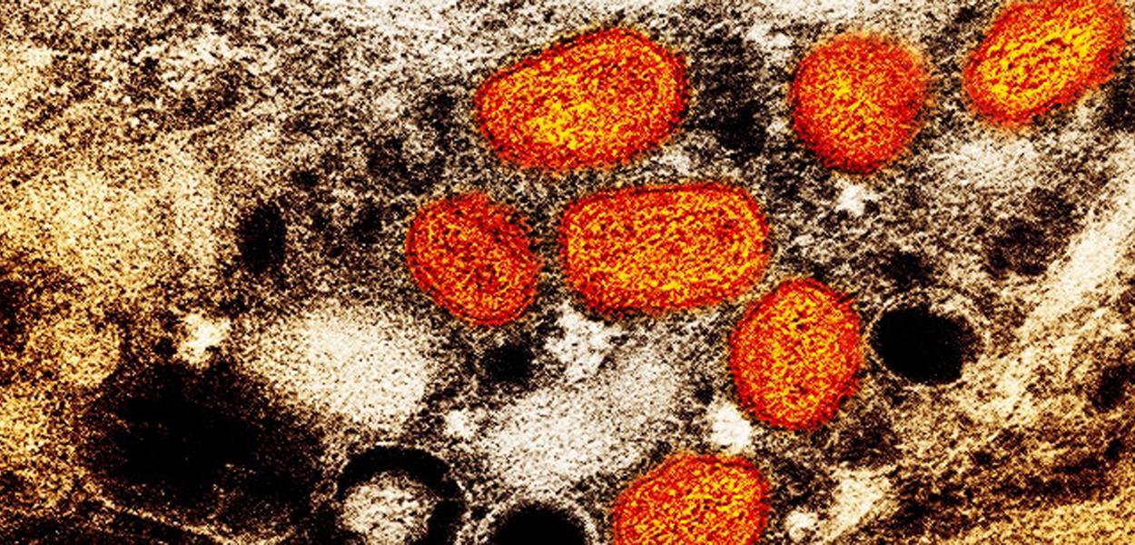 Micrografia eletrônica de transmissão colorida de partículas de varíola de macaco  encontradas dentro de uma célula infectada (azul), cultivadas em laboratório.