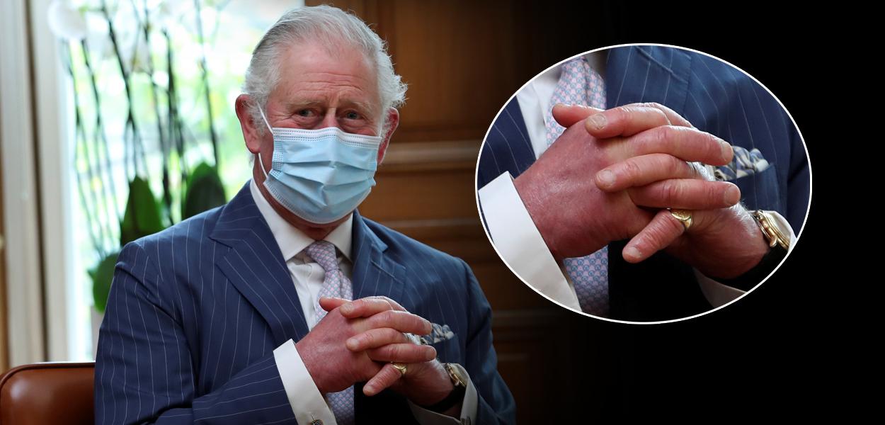 "Dedos de salsicha" do rei Charles III chamaram a atenção