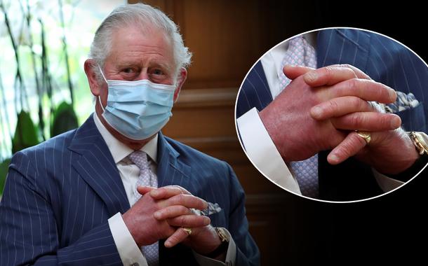 "Dedos de salsicha" do rei Charles III chamaram a atenção