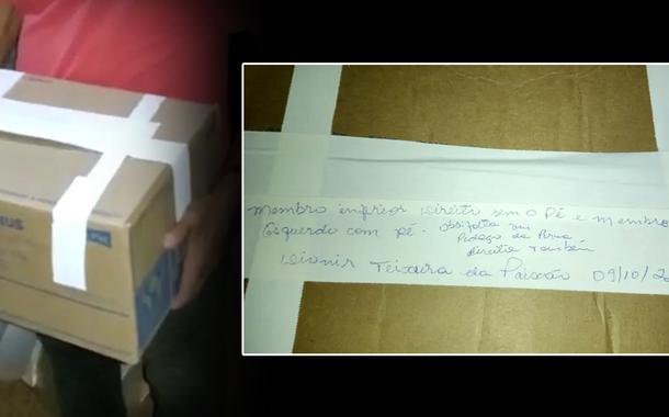 Homem tem pernas amputadas após acidente, e hospital entrega membros à família em caixa de papelão