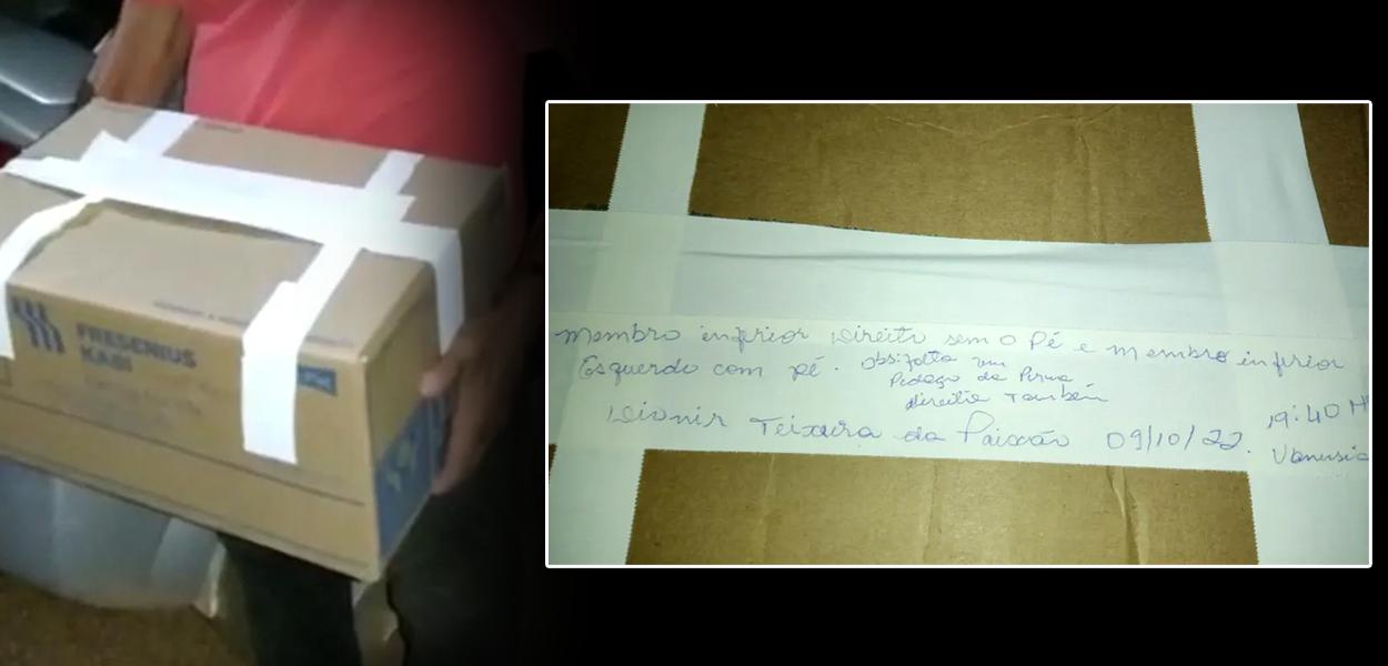 Homem tem pernas amputadas após acidente, e hospital entrega membros à família em caixa de papelão