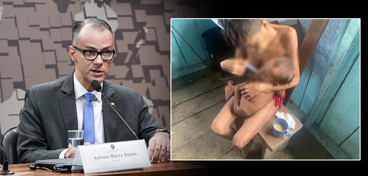 O diretor-presidente da Anvisa se disse indignado com a situação trágica dos yanomamis